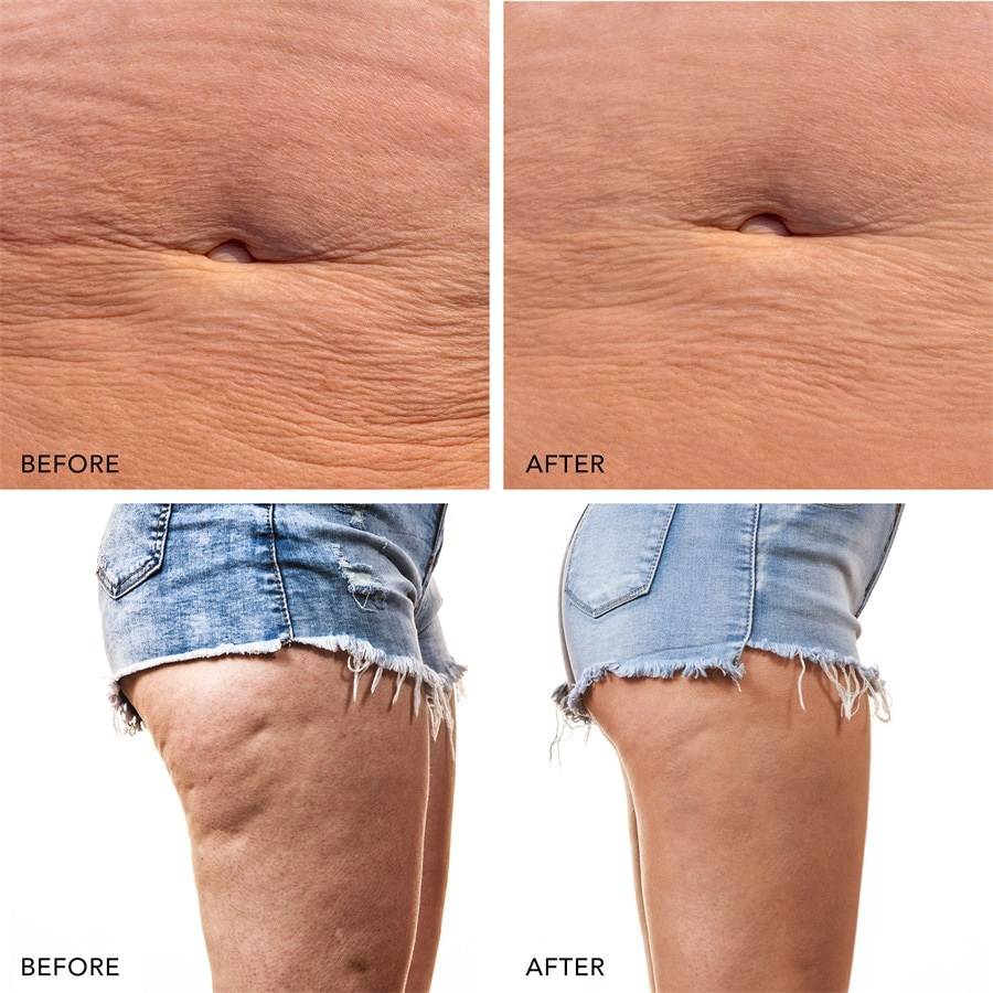 Foreo Body Fabrikverkauf