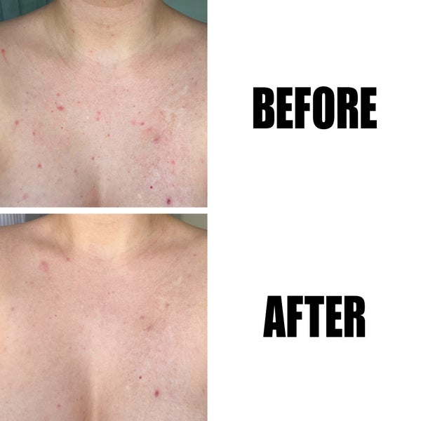 The INKEY List Glycolic Acid Exfoliating Body Stick 45g Hotsell