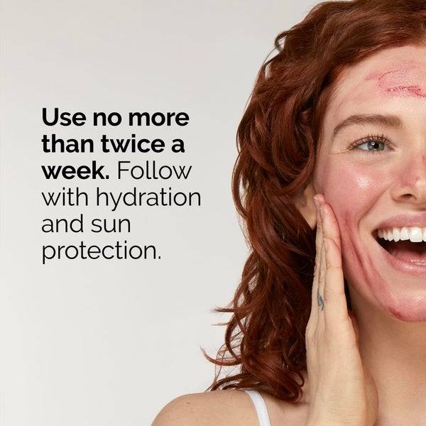The Ordinary AHA 30% + BHA 2% Peeling Solution 30ml Fabrikverkauf