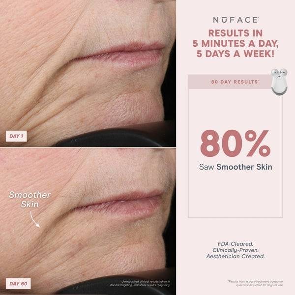 NuFACE® Mini Starter Kit Hotsell