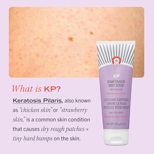First Aid Beauty KP Bump Eraser Body Scrub with 10% AHA 226g Meist gekauft