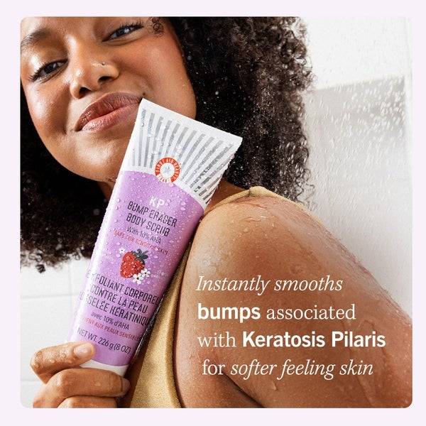 First Aid Beauty KP Bump Eraser Fresh Strawberry Body Scrub with 10% AHA 226g im Angebot