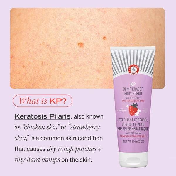 First Aid Beauty KP Bump Eraser Fresh Strawberry Body Scrub with 10% AHA 226g im Angebot