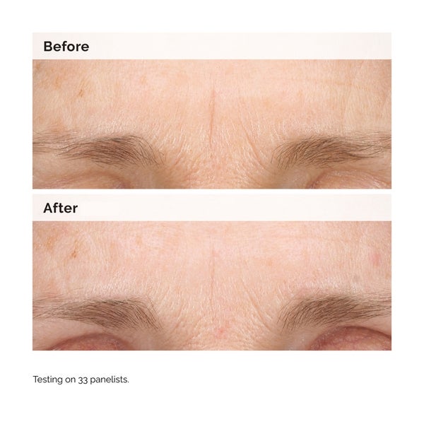 The Ordinary Retinal 0.2% Emulsion 15ml Online