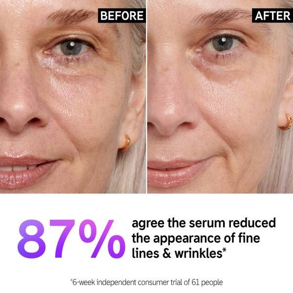 The INKEY List Retinol Serum 30ml Günstiger Verkauf