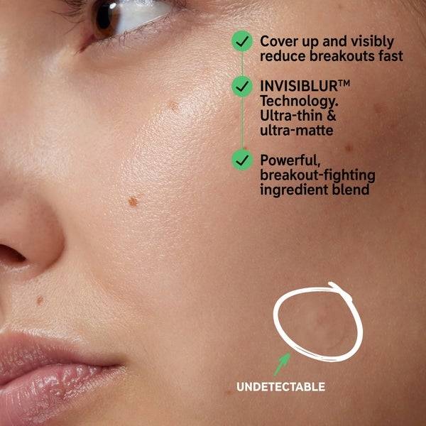 The INKEY List Hydrocolloid Invisible Pimple Patches Blitzverkäufe