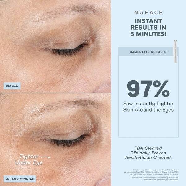 NuFACE FIX Line Smoothing Device 50% Rabatt mit kostenlosem Versand
