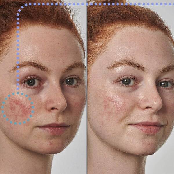 The INKEY List Super Solutions 10% Azelaic Acid Serum 30ml Lagerräumung