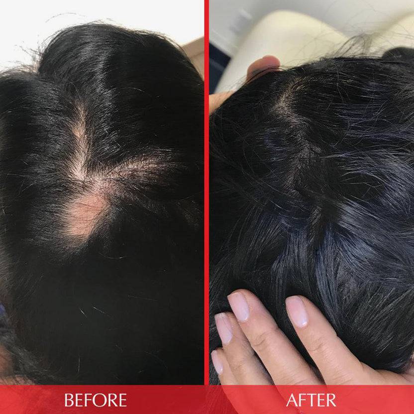 HAIRtamin HAIRtamin Advanced Formula 1 Month Hotsell