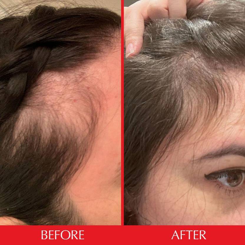 HAIRtamin Gummy Stars™ 1 Month Auslauf