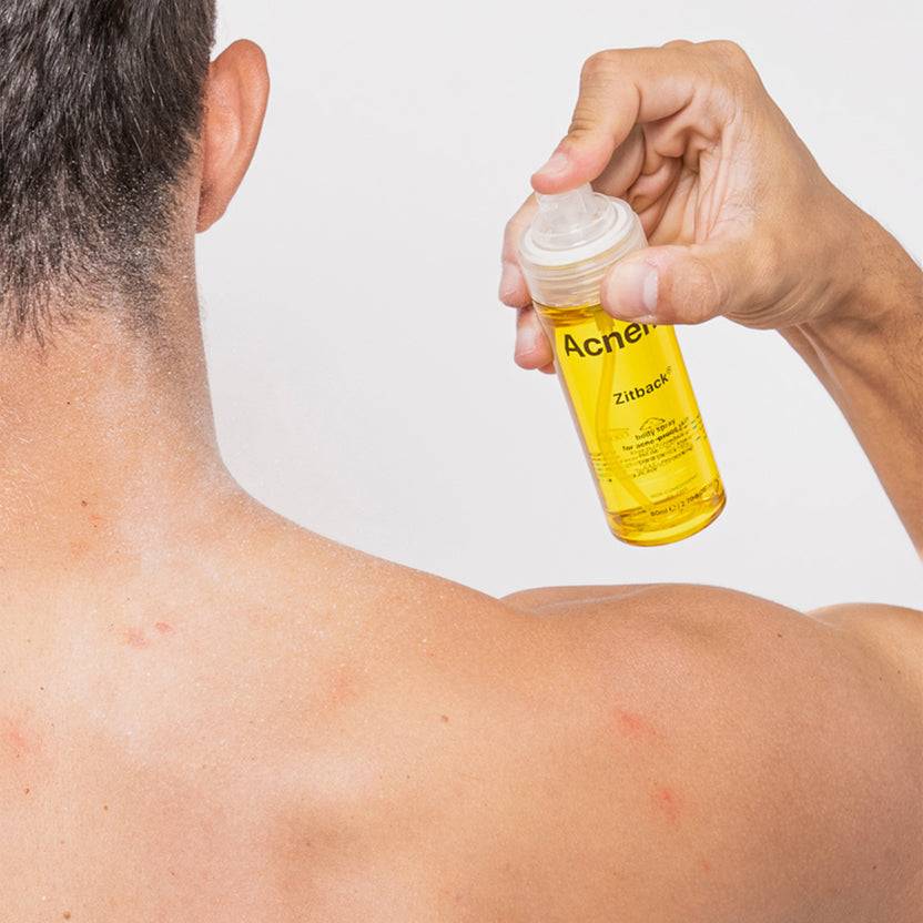 Acnemy Zitback® (80ml) Meist gekauft