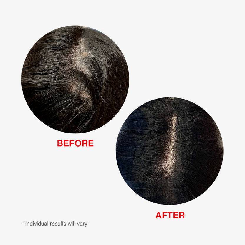 HAIRtamin Scalp Serum (60ml) Verkauf