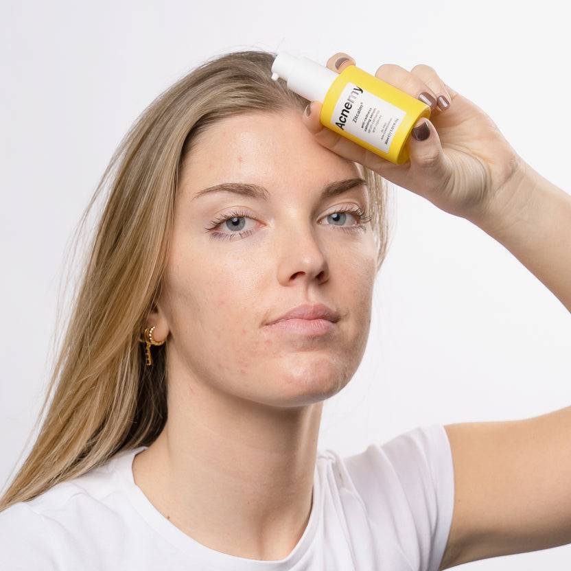 Acnemy Zitcalm Serum (30ml) Vierteljährliche Förderung