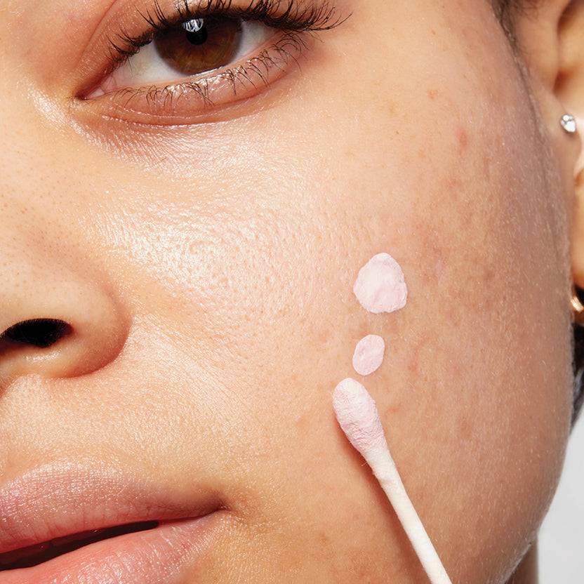 Mario Badescu Acne Control Super Rabatt